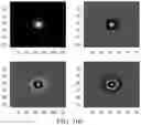 Fig. 10 - Breast calcification imaging phantoms and methods of use