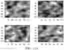 Fig. 11 - Breast calcification imaging phantoms and methods of use