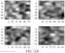 Fig. 13 - Breast calcification imaging phantoms and methods of use