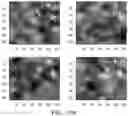 Fig. 14 - Breast calcification imaging phantoms and methods of use