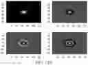 Fig. 15 - Breast calcification imaging phantoms and methods of use