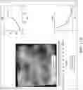 Fig. 17 - Breast calcification imaging phantoms and methods of use