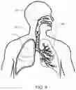 Fig. 06 - Oral device for measuring respiratory sounds