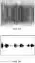 Fig. 09 - Oral device for measuring respiratory sounds