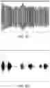 Fig. 10 - Oral device for measuring respiratory sounds