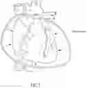 Fig. 02 - Device and method for diagnosis of cardiac tamponade