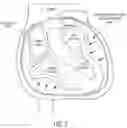 Fig. 03 - Device and method for diagnosis of cardiac tamponade