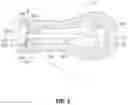 Fig. 04 - DEVICES, SYSTEMS, AND METHODS FOR TRANS-VAGINAL, ULTRASOUND-GUIDED HYSTEROSCOPIC SURGICAL PROCEDURES