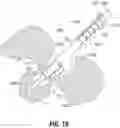 Fig. 18 - DEVICES, SYSTEMS, AND METHODS FOR TRANS-VAGINAL, ULTRASOUND-GUIDED HYSTEROSCOPIC SURGICAL PROCEDURES