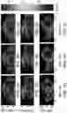 Fig. 05 - SYSTEMS AND METHODS FOR HARMONIC MOTION ELASTOGRAPHY