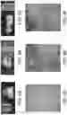 Fig. 07 - SYSTEMS AND METHODS FOR HARMONIC MOTION ELASTOGRAPHY