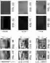 Fig. 08 - SYSTEMS AND METHODS FOR HARMONIC MOTION ELASTOGRAPHY