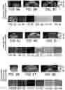 Fig. 09 - SYSTEMS AND METHODS FOR HARMONIC MOTION ELASTOGRAPHY