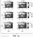Fig. 13 - SYSTEMS AND METHODS FOR HARMONIC MOTION ELASTOGRAPHY