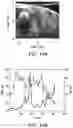 Fig. 15 - SYSTEMS AND METHODS FOR HARMONIC MOTION ELASTOGRAPHY