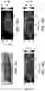 Fig. 19 - SYSTEMS AND METHODS FOR HARMONIC MOTION ELASTOGRAPHY