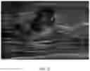 Fig. 04 - METHOD FOR PROVIDING INFORMATION FOR CHOOSING BREAST CANCER TREATMENT METHOD BY USING BREAST CANCER ULTRASONIC IMAGE AND GENE INFORMATION