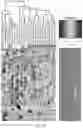 Fig. 06 - METHOD FOR PROVIDING INFORMATION FOR CHOOSING BREAST CANCER TREATMENT METHOD BY USING BREAST CANCER ULTRASONIC IMAGE AND GENE INFORMATION