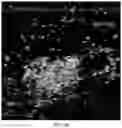 Fig. 07 - METHOD FOR PROVIDING INFORMATION FOR CHOOSING BREAST CANCER TREATMENT METHOD BY USING BREAST CANCER ULTRASONIC IMAGE AND GENE INFORMATION