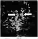 Fig. 08 - METHOD FOR PROVIDING INFORMATION FOR CHOOSING BREAST CANCER TREATMENT METHOD BY USING BREAST CANCER ULTRASONIC IMAGE AND GENE INFORMATION