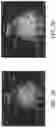 Fig. 04 - SYSTEMS AND METHODS FOR FINDING HEPATO-RENAL INDICES