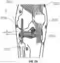 Fig. 03 - Wearable Imaging System for Measuring Bone Displacement