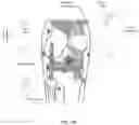 Fig. 08 - Wearable Imaging System for Measuring Bone Displacement