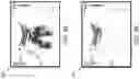 Fig. 08 - Reduction of reverberation artifacts in ultrasound images and associated devices, systems, and methods
