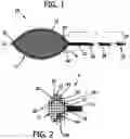 Fig. 02 - Endoscopic snare with asymmetric corners