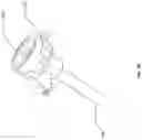 Fig. 13 - Programmable stiffness tissue displacement device