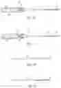 Fig. 09 - Fully-threaded bioabsorbable suture anchor