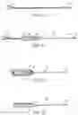 Fig. 11 - Fully-threaded bioabsorbable suture anchor