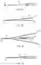 Fig. 12 - Fully-threaded bioabsorbable suture anchor
