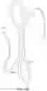 Fig. 28 - Variable denier yarn and suture