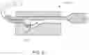 Fig. 32 - Variable denier yarn and suture