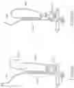 Fig. 38 - Variable denier yarn and suture