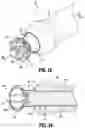 Fig. 12 - PURSE-STRING APPLICATOR FOR CIRCULAR STAPLING INSTRUMENTS