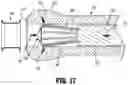 Fig. 13 - PURSE-STRING APPLICATOR FOR CIRCULAR STAPLING INSTRUMENTS