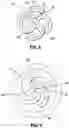 Fig. 06 - SURGICAL OCCLUDING DEVICES