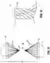 Fig. 10 - SURGICAL OCCLUDING DEVICES