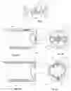 Fig. 05 - SURGICAL CLIP AND DEPLOYMENT SYSTEM