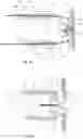 Fig. 11 - SURGICAL CLIP AND DEPLOYMENT SYSTEM