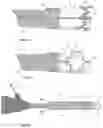 Fig. 25 - SURGICAL CLIP AND DEPLOYMENT SYSTEM