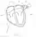 Fig. 04 - SYSTEMS AND METHODS FOR TREATING THE LEFT ATRIAL APPENDAGE