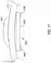 Fig. 12 - Left atrial appendage implant