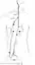 Fig. 06 - SYSTEMS AND METHODS FOR NEUROVASCULAR INTERVENTIONS
