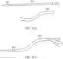 Fig. 14 - SYSTEMS AND METHODS FOR NEUROVASCULAR INTERVENTIONS