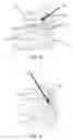 Fig. 04 - Medical instrument