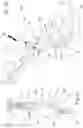 Fig. 06 - BROACH HANDLE FOR A RASP AND SURGICAL DEVICE COMPRISING SAID HANDLE