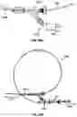 Fig. 15 - SYSTEMS AND METHODS FOR REMOVING MATERIAL FROM A VESSEL